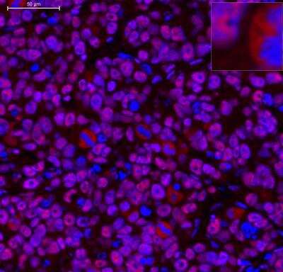 RNA Polymerase II/POLR2A Antibodies: Novus Biologicals